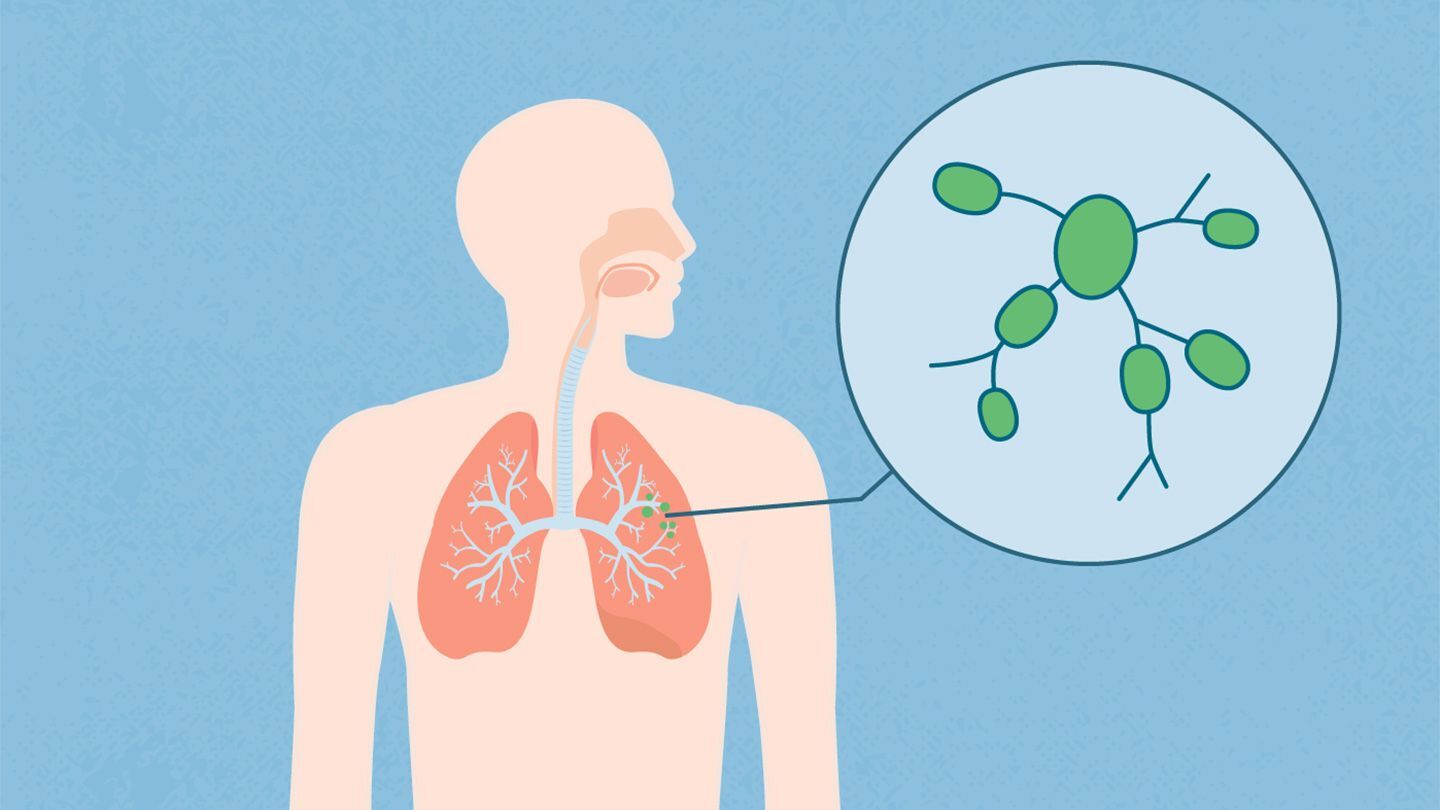 28 Facts About Lymph Nodes