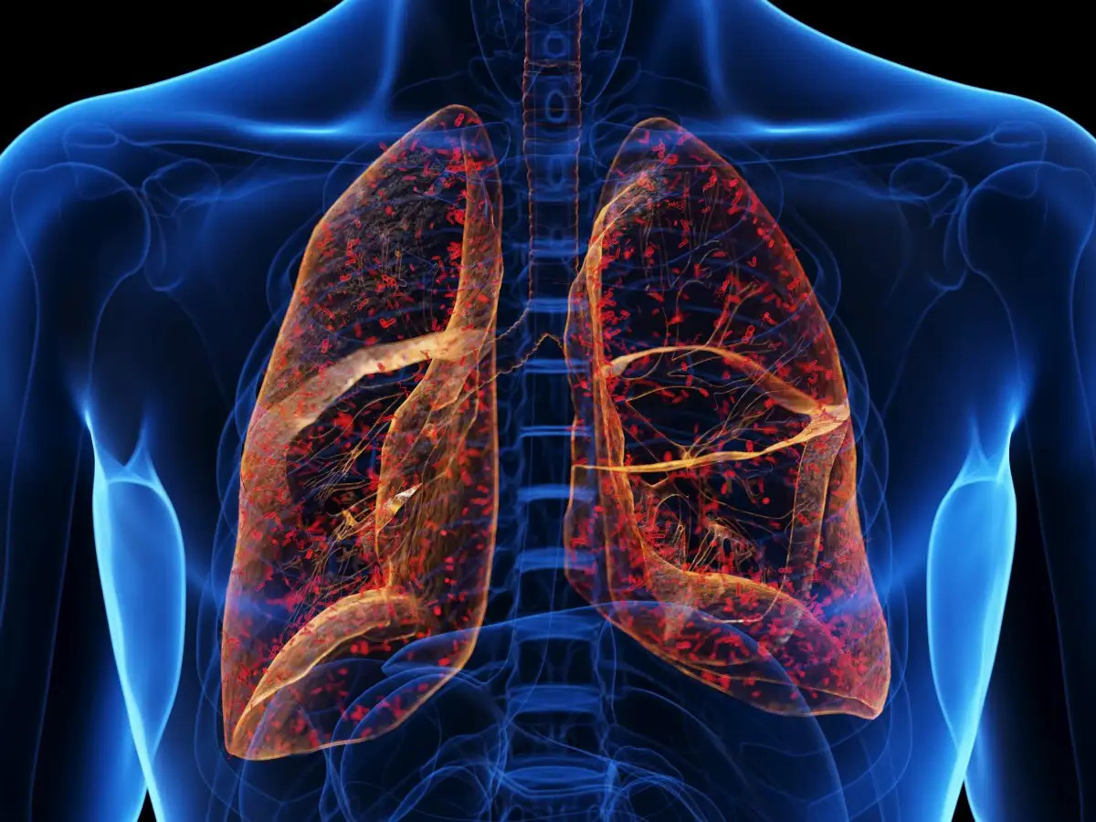 35 Facts About Cystic Fibrosis