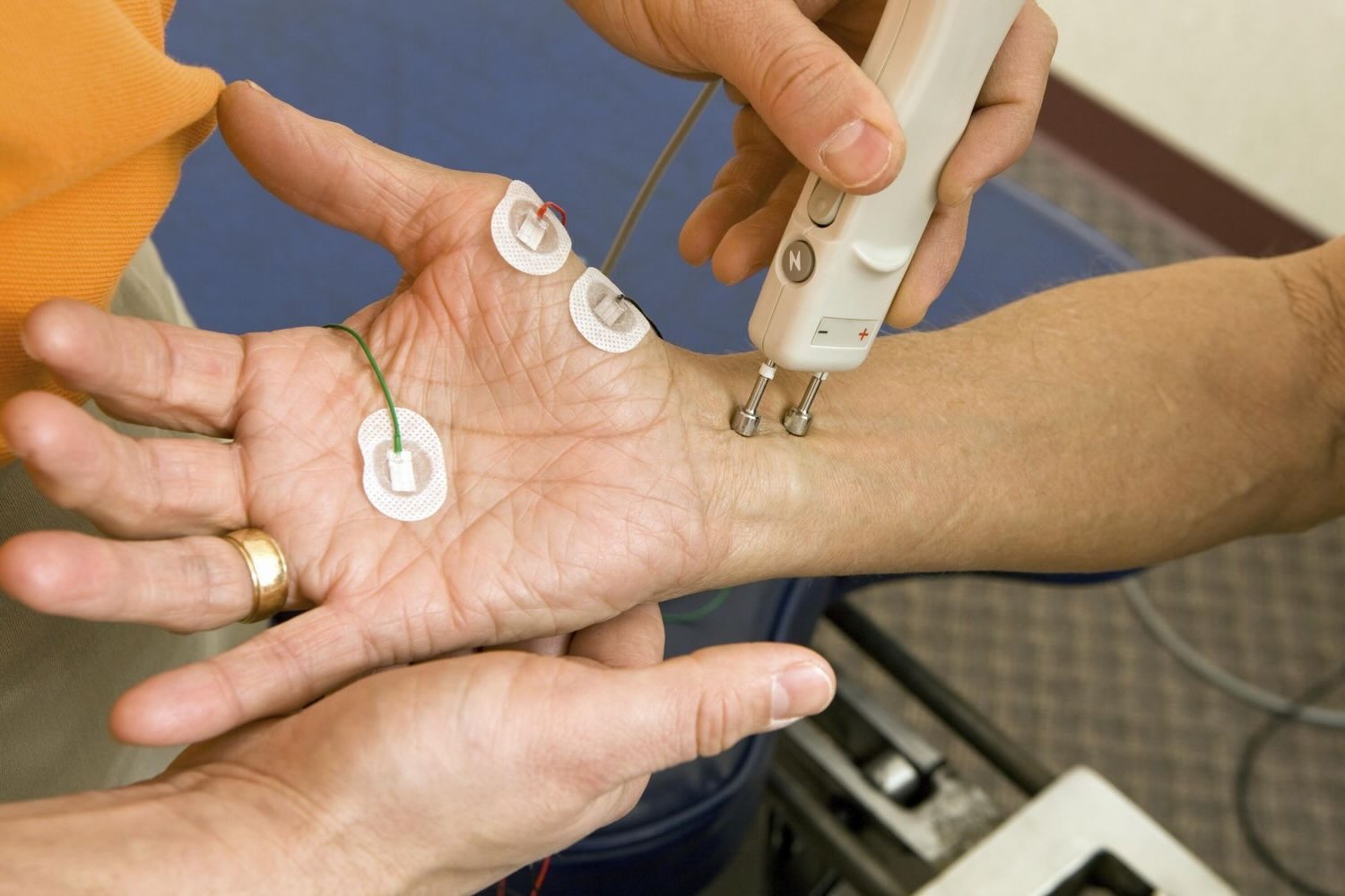 28 Facts About TENS Unit