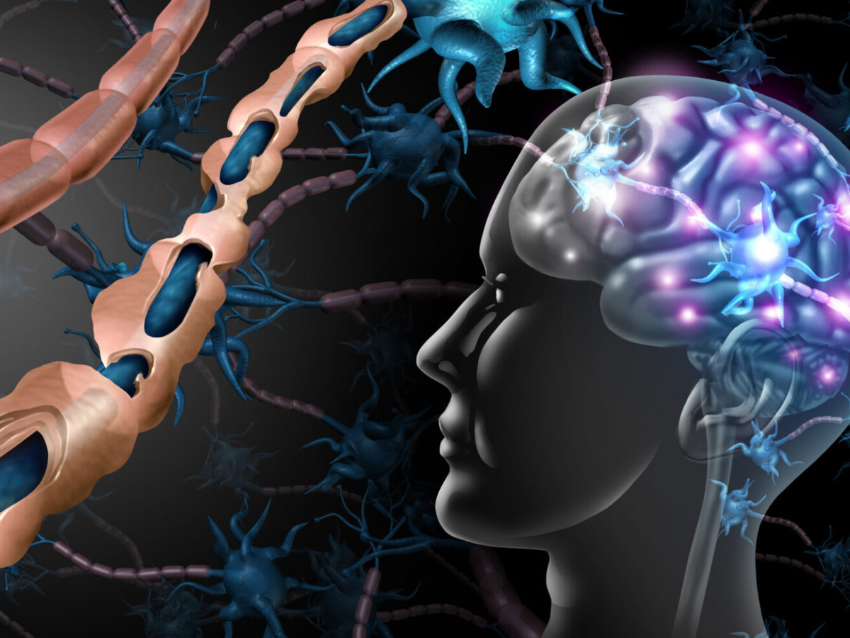 34 Facts About Multiple Sclerosis