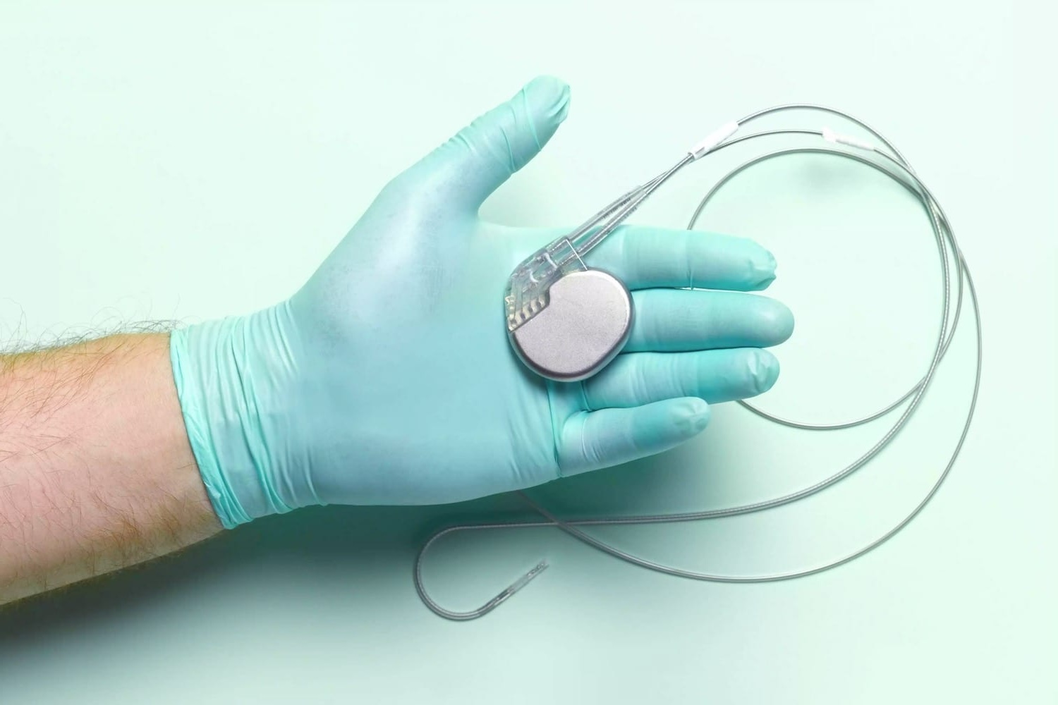 26 Facts About Pacemaker